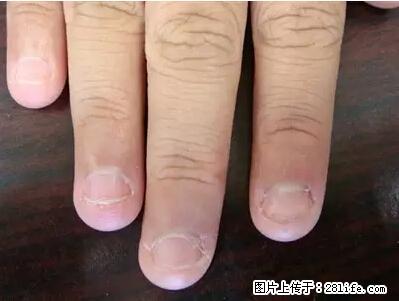 剪指甲、挖耳屎,这些日常小动作竟隐藏大危害! - 乌兰察布生活资讯 - 乌兰察布28生活网 wlcb.28life.net